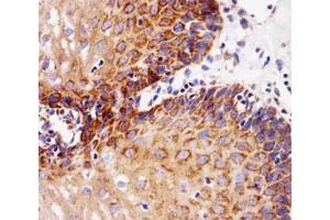 Immunohistochemical analysis of paraffin-embedded human esophagus using EGF Receptor antibody at 1:25 dilution.