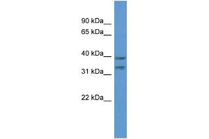 WB Suggested Anti-BRMS1L Antibody Titration: 1. (BRMS1L Antikörper  (C-Term))
