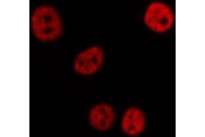 ABIN6276993 staining  Hela cells by IF/ICC. (RPL5 Antikörper  (Internal Region))