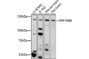 Western blot analysis of extracts of various cell lines, using PPP1R9B antibody (ABIN7269680) at 1:1000 dilution. (PPP1R9B Antikörper)