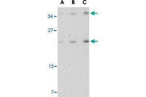 Western blot analysis of DARC in mouse brain tissue lysate with DARC polyclonal antibody  at (A) 0. (DARC Antikörper  (C-Term))