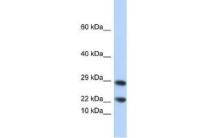 Lipocalin 8 antibody used at 1 ug/ml to detect target protein.