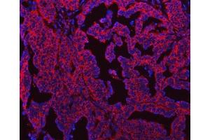 IF analysis of SEPT7/SEPTIN7 using anti-SEPT7/SEPTIN7 antibody (ABIN7599301).