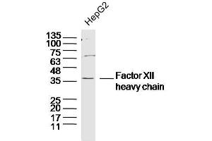 Human HepG2 cells probed with Factor XII heavy chain Polyclonal Antibody, unconjugated  at 1:300 overnight at 4°C followed by a conjugated secondary antibody at 1:10000 for 90 minutes at 37°C. (Factor 12 Heavy Chain (F12) Antikörper)