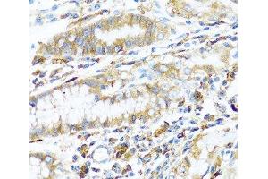 Immunohistochemistry of paraffin-embedded Human stomach using HLA-DPB1 Polyclonal Antibody at dilution of 1:100 (40x lens).