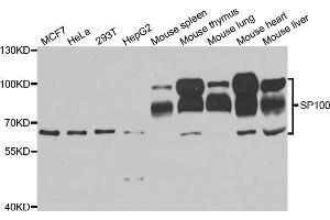Western blot analysis of extracts of various cell lines, using SP100 antibody. (SP100 Antikörper)