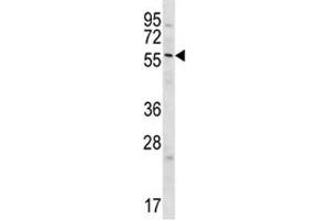 GPC3 antibody western blot analysis in Jurkat lysate (Glypican 3 Antikörper  (AA 529-560))