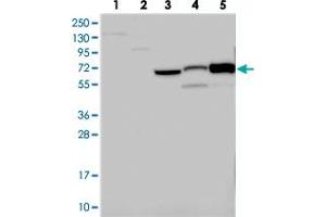 Western blot analysis of Lane 1: RT-4, Lane 2: U-251 MG, Lane 3: Human Plasma, Lane 4: Liver, Lane 5: Tonsil with CNNM1 polyclonal antibody . (Cyclin M1 Antikörper)