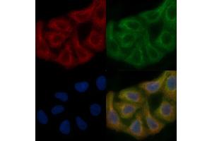 PMPCA Mouse Monoclonal Antibody staining Hela cells by IF/ICC. (PMPCA Antikörper)