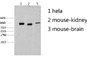 Western blot analysis of 1) Hela, 2) mouse kidney, 3) mouse brain, diluted at 1:2000. (Cytokeratin 7 Antikörper)