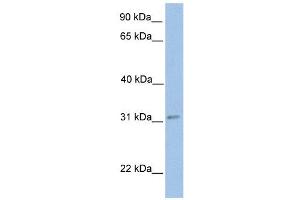 ECHDC2 antibody used at 1 ug/ml to detect target protein. (ECHDC2 Antikörper  (Middle Region))