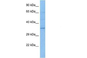 Western Blotting (WB) image for anti-D4, Zinc and Double PHD Fingers Family 1 (DPF1) (Middle Region) antibody (ABIN2775774)