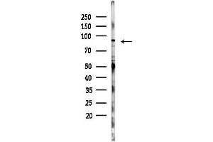 anti-RUN and FYVE Domain Containing 1 (RUFY1) (Internal Region) antibody