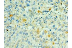 Immunohistochemistry (IHC) image for anti-SHC (Src Homology 2 Domain Containing) Family, Member 4 (SHC4) (AA 1-185) antibody (ABIN7169519)