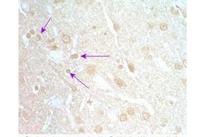 Rat brain tissue was stained by Rabbit Anti-Neuromedin S Prepro (70-103) (Rat) Serum (NMS Antikörper  (Preproprotein))