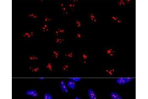 Confocal immunofluorescence analysis of U2OS cells using DDX21 Polyclonal Antibody at dilution of 1:100. (DDX21 Antikörper)