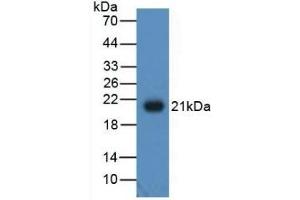Detection of Recombinant ADP, Human using Polyclonal Antibody to Adiponectin (ADPN) (ADIPOQ Antikörper  (AA 108-244))