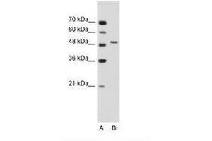 Image no. 3 for anti-Semenogelin I (SEMG1) (AA 51-100) antibody (ABIN203500) (SEMG1 Antikörper  (AA 51-100))