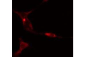 Immunofluorescence (fixed cells) (IF/ICC) image for anti-serpin Peptidase Inhibitor, Clade B (Ovalbumin), Member 9 (SERPINB9) (Internal Region) antibody (ABIN6258410)