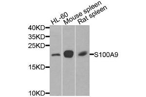 Western blot analysis of extracts of various cell lines, using S100A9 antibody (ABIN6003574) at 1/1000 dilution. (S100A9 Antikörper)