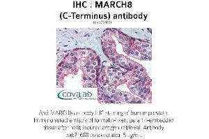 Image no. 2 for anti-Membrane-Associated Ring Finger (C3HC4) 8, E3 Ubiquitin Protein Ligase (MARCH8) (C-Term) antibody (ABIN1736759) (MARCH8 Antikörper  (C-Term))