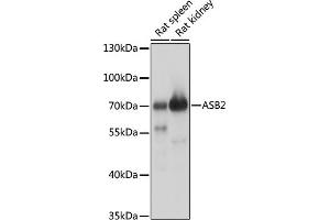 Western blot analysis of extracts of various cell lines, using  antibody (ABIN7265612) at 1:1000 dilution. (ASB2 Antikörper  (AA 448-587))