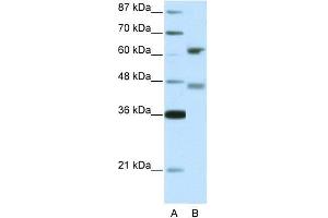 Human 293T; WB Suggested Anti-RFX4 Antibody Titration: 5. (RFX4 Antikörper  (Middle Region))