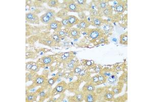 Immunohistochemistry of paraffin-embedded mouse liver using  antibody (ABIN6129195, ABIN6137096, ABIN6137097 and ABIN6220538) at dilution of 1:100 (40x lens). (ARHGEF5 Antikörper  (AA 1248-1597))