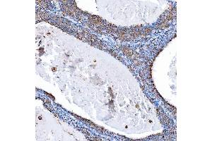 IHC analysis of SH2D4A using anti-SH2D4A antibody (ABIN7601695).