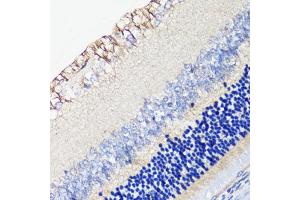 Immunohistochemistry of paraffin-embedded rat retina using DRD4 antibody (ABIN1679595, ABIN5663875, ABIN5663877 and ABIN6217338) at dilution of 1:100 (40x lens). (DRD4 Antikörper  (AA 100-200))
