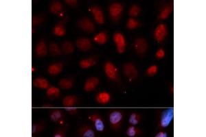 Immunofluorescence analysis of U2OS cells using Pea3 / ETV4 Polyclonal Antibody (ETV4 Antikörper)