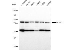 Western blotting analysis using ACAP2 antibody (ABIN7797642). (Rekombinanter Centaurin beta 2 Antikörper)