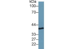 Detection of SYTL2 in Porcine Cerebrum lysate using Polyclonal Antibody to Synaptotagmin Like Protein 2 (SYTL2) (SYTL2 Antikörper  (AA 329-880))