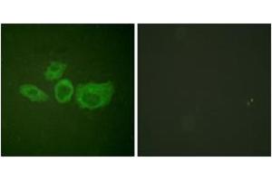 Immunofluorescence analysis of HuvEc cells, using Tyrosine Hydroxylase (Ab-40) Antibody. (Tyrosine Hydroxylase Antikörper  (AA 41-90))