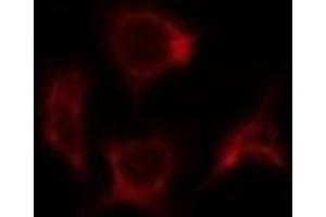 ABIN6278180 staining 293T by IF/ICC. (SOCS2 Antikörper)