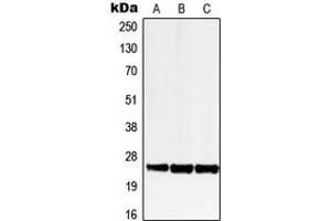 Western blot analysis of LRAT expression in HEK293T (A), SP2/0 (B), H9C2 (C) whole cell lysates. (LRAT Antikörper  (Center))