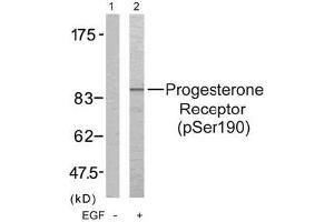 Image no. 3 for anti-Progesterone Receptor (PGR) (pSer190) antibody (ABIN196746) (Progesterone Receptor Antikörper  (pSer190))