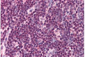 anti-Interferon Regulatory Factor 8 (IRF8) (C-Term) antibody