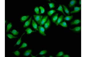 Immunofluorescence staining of A549 cells with ABIN7164376 at 1:166, counter-stained with DAPI. (DHX34 Antikörper  (AA 418-554))