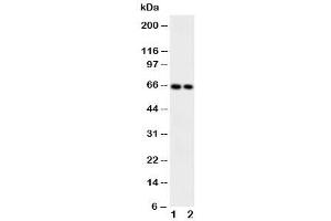 Western blot testing of CaMKK2 antibody and Lane 1:  rat brain (CAMKK2 Antikörper  (Middle Region))