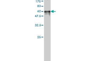 Western Blot detection against Immunogen (57. (PIH1D1 Antikörper  (AA 1-290))