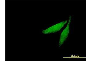 Immunofluorescence of purified MaxPab antibody to CAMK2G on HeLa cell. (CAMKII gamma Antikörper  (AA 1-527))
