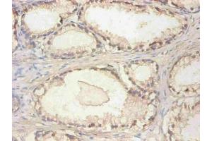 Immunohistochemical of paraffin-embedded human prostate tissue using ABIN7148973 at dilution of 1:200 (CST3 Antikörper)