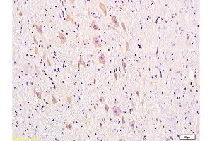 Formalin-fixed and paraffin embedded rat brain tissue labeled with Anti-DRD1 Polyclonal Antibody, Unconjugated  at 1:300, followed by conjugation to the secondary antibody and DAB staining (Dopamine Receptor d1 Antikörper  (AA 101-200))