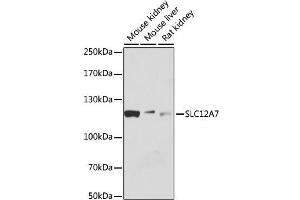 Western blot analysis of extracts of various cell lines, using SLC12A7 antibody. (SLC12A7 Antikörper)