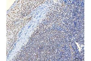 IHC analysis of HnRNP H/HNRNPH1 using anti-HnRNP H/HNRNPH1 antibody (ABIN4886623).