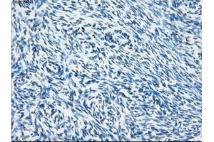 Immunohistochemical staining of paraffin-embedded colon tissue using anti-SORDmouse monoclonal antibody. (SORD Antikörper)