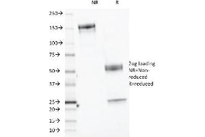 SDS-PAGE Analysis Purified CELA3B Monoclonal Antibody (CELA3B/1218). (Elastase 3B Antikörper  (AA 82-238))