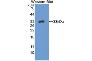 Detection of Recombinant BRCA1, Mouse using Polyclonal Antibody to Breast Cancer Susceptibility Protein 1 (BRCA1) (BRCA1 Antikörper  (AA 1524-1781))