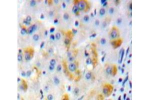 Used in DAB staining on fromalin fixed paraffin-embedded Liver tissue (ADCY2 Antikörper  (AA 294-525))